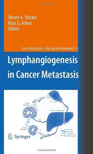 Lymphangiogenesis in Cancer Metastasis: 13 (Cancer Metastasis - Biology and Treatment)