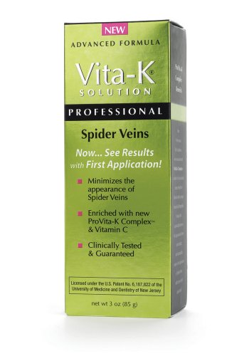 spider vein treatment