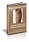 Removing Varicose Veins - Information and Tips about the Treatment of Varicose Veins