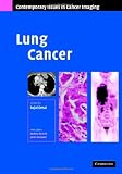 Lung Cancer (Contemporary Issues in Cancer Imaging)