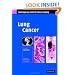 Lung Cancer (Contemporary Issues in Cancer Imaging)