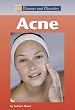 Acne (Diseases & disorders series)