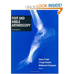 Foot and Ankle Arthroscopy