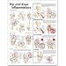 Hip and Knee Inflammations Anatomical Chart 2nd Edition