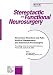Stereotactic and Functional Neurosurgery: Movement Disorders and Pain: Medical Management and Functional Neurosurgery (Stereotactic and Functional Neurosurgery)