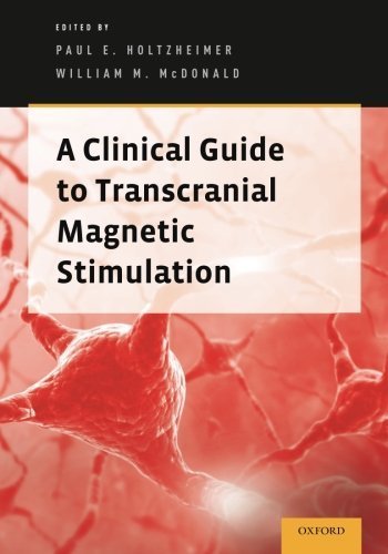 A Clinical Guide to Transcranial Magnetic Stimulation (2014-03-21)