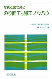 写真と図で見るのり面工の施工ノウハウ