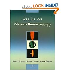 Atlas of Vitreous Biomicroscopy
