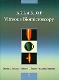 Atlas of Vitreous Biomicroscopy