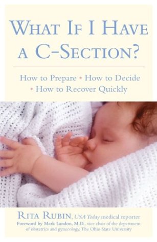 Cesarean-Section