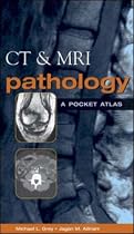 CT & MRI Pathology : A Pocket Atlas