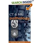 CT and MRI Pathology : A Pocket Atlas by Michael L Grey and Jagan Mohan Ailinani