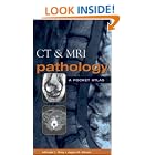 CT and MRI Pathology : A Pocket Atlas by Michael Grey and Jagan Ailinani