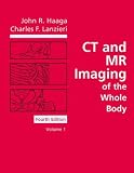 CT and MR Imaging of the Whole Body (2-Volume Set)