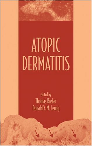 Dermatitis