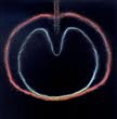 Wasp Star (Apple Venus Vol.2)
