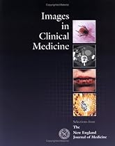 Images in Clinical Medicine: Selections from The New England Journal of Medicine Images in Clinical Medicine: Selections from The New England Journal of Medicine