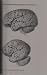 Brain development and thyroid deficiency: [proceedings of the Symposium on Brain Development and Thyroid Deficiency, held at the Royal Netherlands Academy ... and Sciences at Amsterdam, June 11th, 1974]