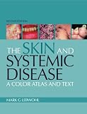 Atlas of the Skin and Systemic Disease