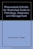 Rheumatoid arthritis : an illustrated guide to pathology diagnosis and management