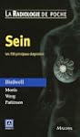 Sein : Les 100 principaux diagnostics
