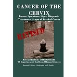 Cancer Of The Cervix: Causes, Symptoms, Signs, Diagnosis, Treatments, Stages of Cervical Cancer- Revised Edition - Illustrated by S. Smith