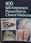 400 Self-Assessment Picture Tests in Clinical Medicine
