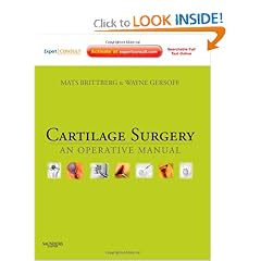 Cartilage Surgery: An Operative Manual, Expert Consult: Online and Print by Mats Brittberg MD PhD and Wayne Gersoff MD