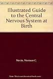 Illustrated guide to malformations of the central nervous system at birth = Guide illustré des malformations du système nerveux central à la naissance = Illustrierter Leitfaden der Mißbildungen des Ze