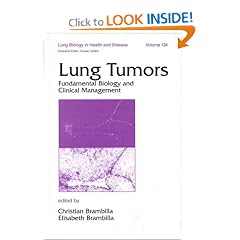 Lung Tumors: Fundamental Biology and Clinical Management (Lung Biology in Health and Disease)