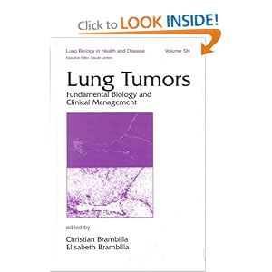 Lung Tumors: Fundamental Biology and Clinical Management (Lung Biology in Health and... by Christian Brambilla