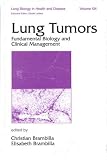 Lung Tumors: Fundamental Biology and Clinical Management (Lung Biology in Health and Disease)