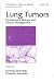 Lung Tumors: Fundamental Biology and Clinical Management (Lung Biology in Health and Disease)