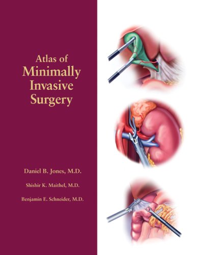 Surgery