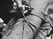 Doctors at Ohio State Removing Growth of Pre Injected Cancerous Cells from Prisoner's Arm Photographic Poster Print by Peter Stackpole, 16x12