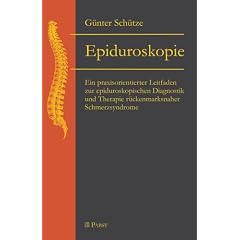 Epiduroskopie