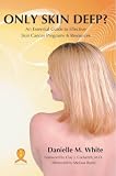 Only Skin Deep?: An Essential Guide to Effective Skin Cancer Programs and Resources