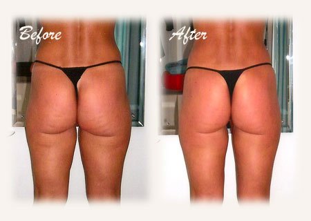 Best Selling price IT Works! Body Wraps. (4) Ultimate Body Applicators.