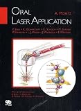  : Oral Laser Application