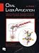 Books : Oral Laser Application