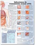 Sexually Transmitted Infections Anatomical Chart in Spanish