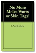 No More Moles Warts or Skin Tags!