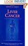 Liver Cancer (M.D. Anderson Solid Tumor Oncology Series)