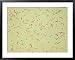 Legionella Pneumophilia Framed Art Poster Print by G. W. Willis, 39x31
