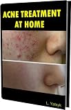 414njploXJL. SL160  Acne Treatment at Home   Best Recipes, Aromatherapy against Acne (Acne treatments:How to cure acne)