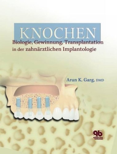 Transplantation