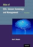 Atlas of EEG and seizure semiology and management