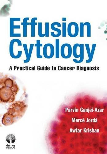 Effusion Cytology: A Practical Guide to Cancer Diagnosis by Parvin Ganjei-Azar MD (2011-03-04)