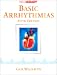 Basic Arrhythmias (5th Edition)