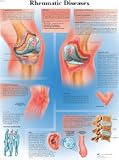 Rheumatic Diseases Chart